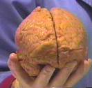 Brain at Los Alamos